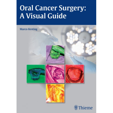 Oral Cancer Surgery: A Visual Guide