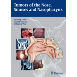 Tumors of the Nose, Sinuses and Nasopharynx