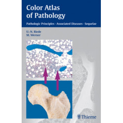 Color Atlas of Pathology: Pathologic Principles, Associated Diseases, Sequela