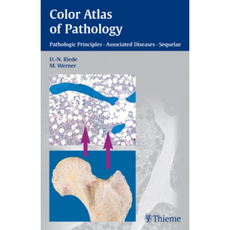 Color Atlas of Pathology: Pathologic Principles, Associated Diseases, Sequela