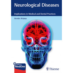 Neurological Diseases: Implications in Medical and Dental Practices