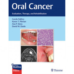 Oral Cancer: Evaluation, Therapy, and Rehabilitation