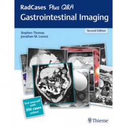 RadCases Plus Q&a Gastrointestinal Imaging