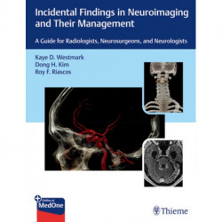 Incidental Findings in Neuroimaging and Their Management: A Guide for Radiologists, Neurosurgeons, and Neurologists