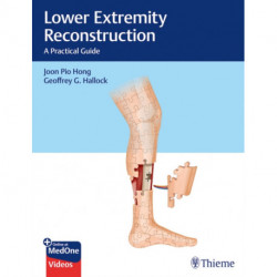 Lower Extremity Reconstruction: A Practical Guide