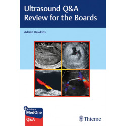 Ultrasound Q&a Review for the Boards