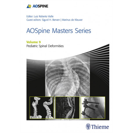 AOSpine Masters Series, Volume 9: Pediatric Spinal Deformities