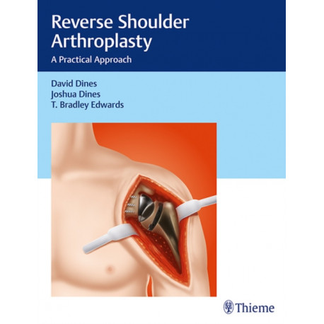 Reverse Shoulder Arthroplasty: A Practical Approach