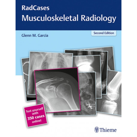 RadCases Q&a Musculoskeletal Radiology