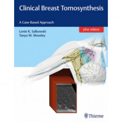 Clinical Breast Tomosynthesis: A Case-Based Approach