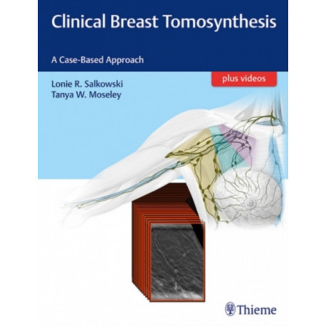 Clinical Breast Tomosynthesis: A Case-Based Approach