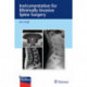 Instrumentation for Minimally Invasive Spine Surgery