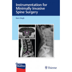 Instrumentation for Minimally Invasive Spine Surgery