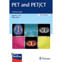 PET and PET/CT: A Clinical Guide