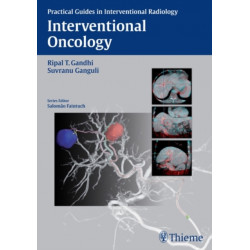 Interventional Oncology