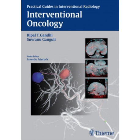 Interventional Oncology