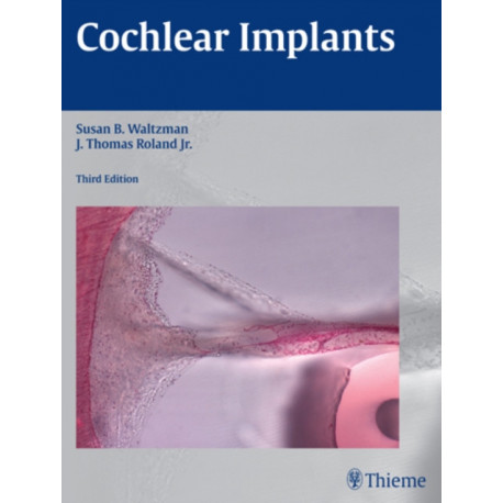 Cochlear Implants