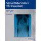 Spinal Deformities: The Essentials