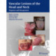 Vascular Lesions of the Head and Neck: Diagnosis and Management