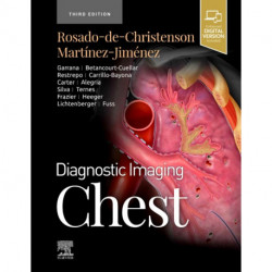 Diagnostic Imaging: Chest