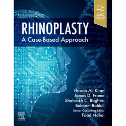 Rhinoplasty: a Case-based approach