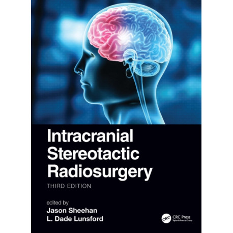 Intracranial Stereotactic Radiosurgery