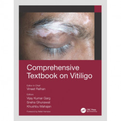 Comprehensive Textbook on Vitiligo