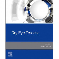 Dry Eye Disease