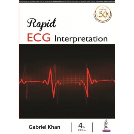 Rapid ECG Interpretation
