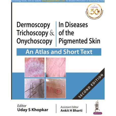 Dermoscopy, Trichoscopy and Onychoscopy in Diseases of the Pigmented Skin: An Atlas and Short Text