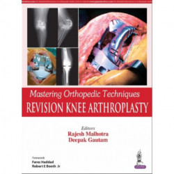 Mastering Orthopedic Techniques: Revision Knee Arthroplasty