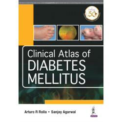 Clinical Atlas of Diabetes Mellitus