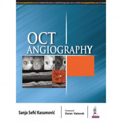 OCT Angiography