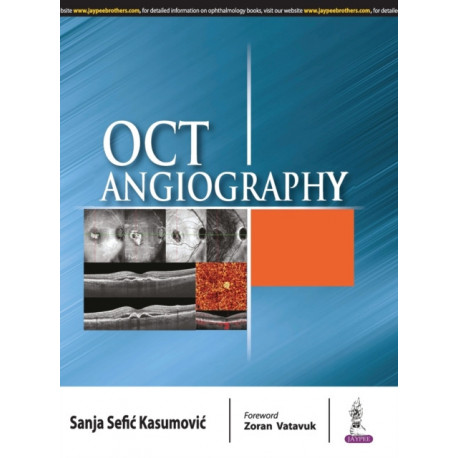 OCT Angiography