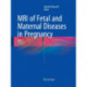 MRI of Fetal and Maternal Diseases in Pregnancy