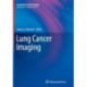 Lung Cancer Imaging