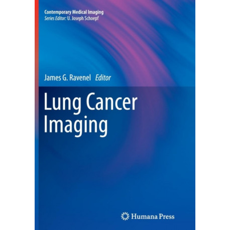 Lung Cancer Imaging