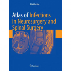 Atlas of Infections in Neurosurgery and Spinal Surgery