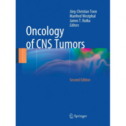 Oncology of CNS Tumors