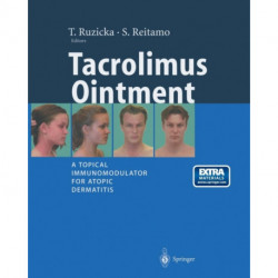 Tacrolimus Ointment: A Topical Immunomodulator for Atopic Dermatitis