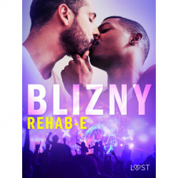 Blizny – gejowskie opowiadanie erotyczne