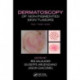 Dermatoscopy of Non-Pigmented Skin Tumors: Pink - Think - Blink