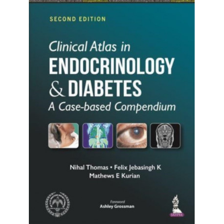 Clinical Atlas in Endocrinology and Diabetes: A Case-based Compendium