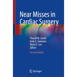 Near Misses in Cardiac Surgery