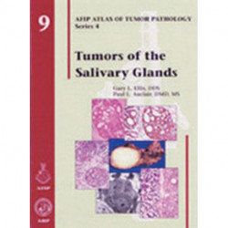 Tumors of the Salivary Glands