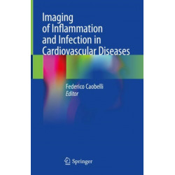Imaging of Inflammation and Infection in Cardiovascular Diseases