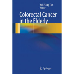 Colorectal Cancer in the Elderly