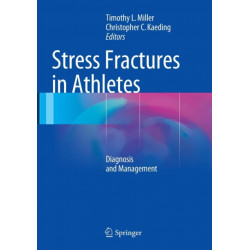 Stress Fractures in Athletes: Diagnosis and Management