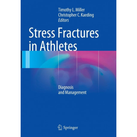 Stress Fractures in Athletes: Diagnosis and Management