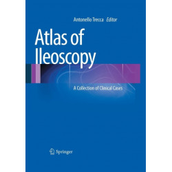Atlas of Ileoscopy: A Collection of Clinical Cases